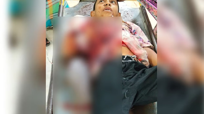 মিরপুরে ককটেল বিস্ফোরণে শিশু আহত