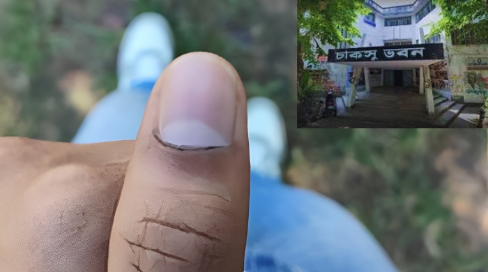 চাকসু নির্বাচনে ভোটের কালি নিয়ে অনিয়মের অভিযোগ