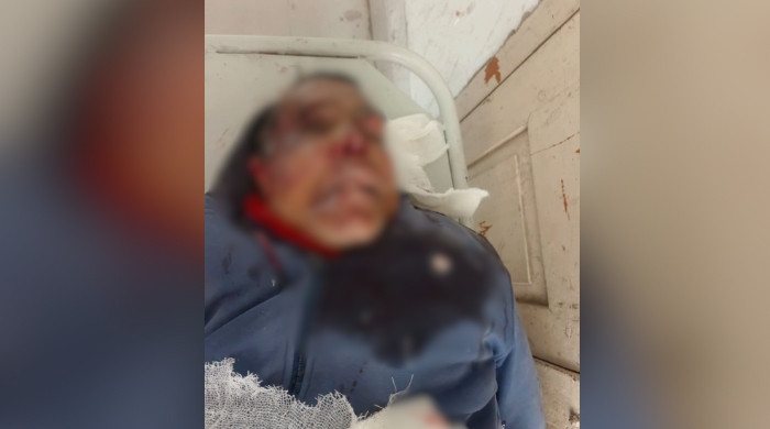 চন্দ্রা ফ্লাইওভারের ডিভাইডারের সাথে মোটরসাইকেল ধাক্কা, নিহত ১