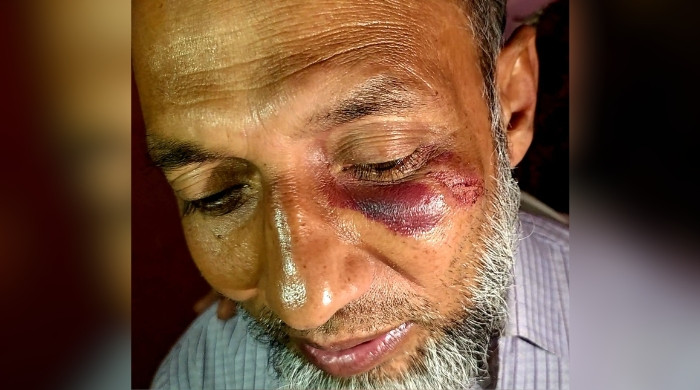 নির্বাচনের ফল ঘোষণার পর হামলা, আহত চিফ এজেন্টকে দেখতে গেলেন প্রার্থী